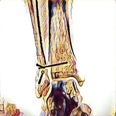 Травма-2