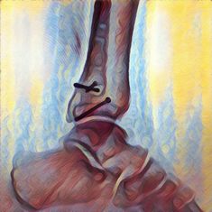 Травма-2