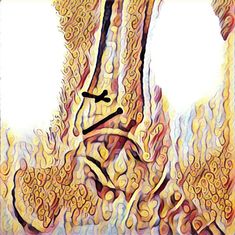 Травма-2